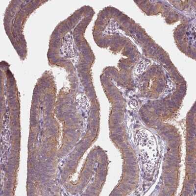 Immunohistochemistry-Paraffin: UBPY/USP8 Antibody [NBP2-55627]
