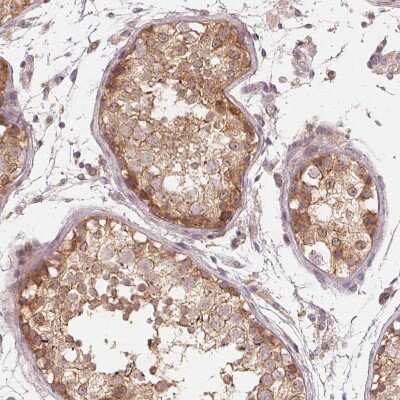 Immunohistochemistry-Paraffin: UBPY/USP8 Antibody [NBP2-55627]