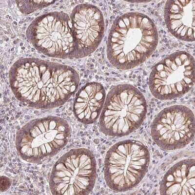 Immunohistochemistry-Paraffin: UBPY/USP8 Antibody [NBP2-55627]