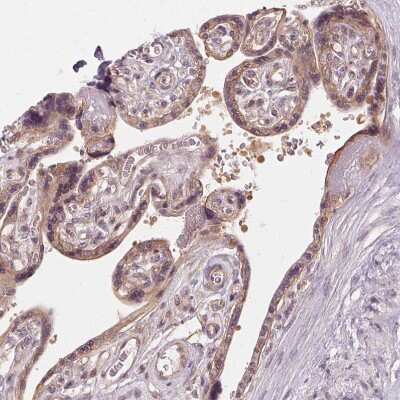 Immunohistochemistry-Paraffin: UBPY/USP8 Antibody [NBP2-55627]