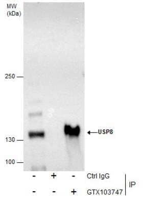 Immunoprecipitation: UBPY/USP8 Antibody [NBP2-20792]