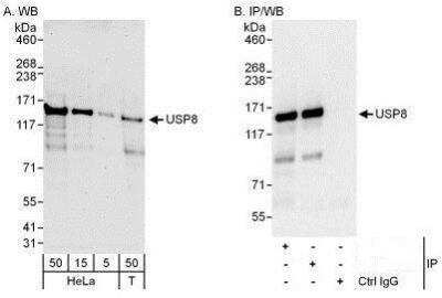 Western Blot: UBPY/USP8 Antibody [NBP1-50001]