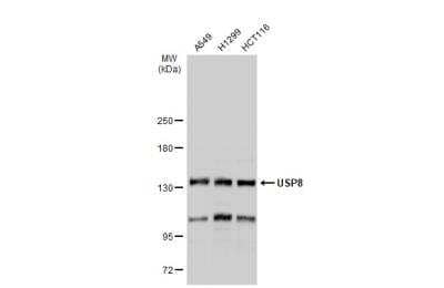 Western Blot: UBPY/USP8 Antibody [NBP2-20792]