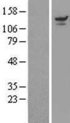 Western Blot: UBPY/USP8 Overexpression Lysate [NBL1-17672]