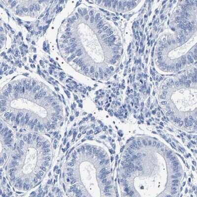 Immunohistochemistry-Paraffin: UBQLN3 Antibody [NBP1-86896]
