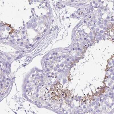 Immunohistochemistry-Paraffin: UBQLN3 Antibody [NBP2-38944]