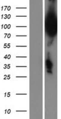 Western Blot: UBQLN3 Overexpression Lysate [NBP2-06976]