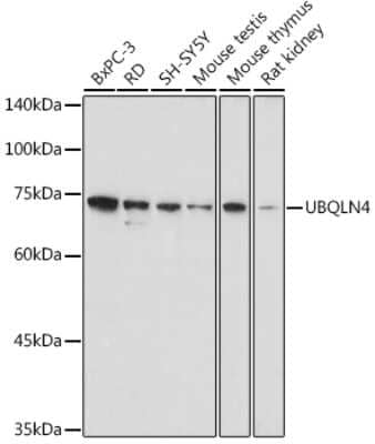 Western Blot: UBQLN4/CIP75 AntibodyAzide and BSA Free [NBP2-94330]