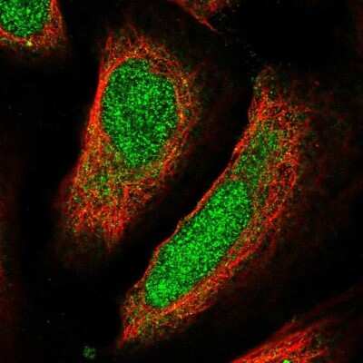 Immunocytochemistry/ Immunofluorescence: UBQLN4/CIP75 Antibody [NBP2-49346]