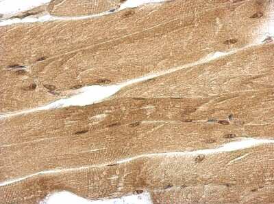 Immunohistochemistry-Paraffin: UBQLN4/CIP75 Antibody [NBP2-20793]