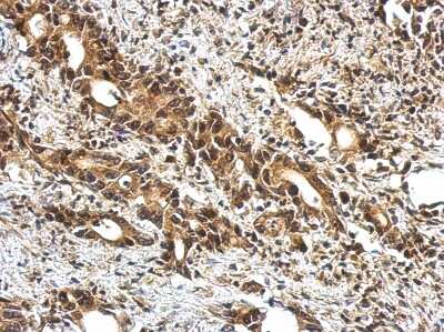 Immunohistochemistry-Paraffin: UBQLN4/CIP75 Antibody [NBP2-20793]