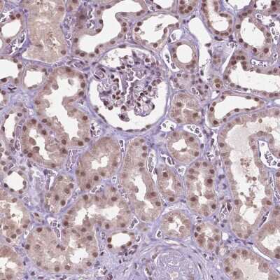 Immunohistochemistry-Paraffin: UBQLN4/CIP75 Antibody [NBP2-49346]