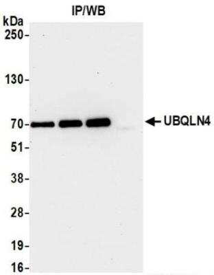 Immunoprecipitation: UBQLN4/CIP75 Antibody (BLR145J) [NBP3-14725]