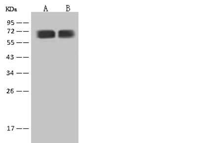 Western Blot: UBQLN4/CIP75 Antibody [NBP2-98562]