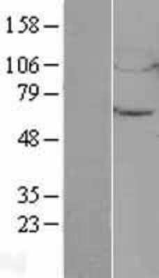 Western Blot: UBQLN4/CIP75 Overexpression Lysate [NBL1-17566]