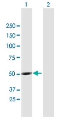 Western Blot: UBQLNL Antibody [H00143630-B01P]