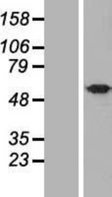 Western Blot: UBQLNL Overexpression Lysate [NBL1-17567]