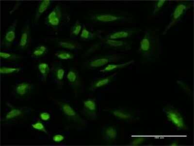 Immunocytochemistry/ Immunofluorescence: UBR1 Antibody (4G7) [H00197131-M02]