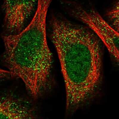 Immunocytochemistry/ Immunofluorescence: UBR1 Antibody [NBP1-86253]