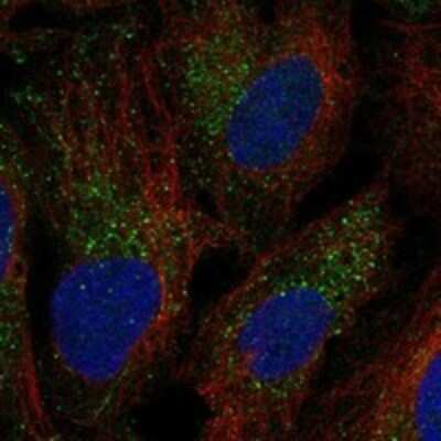 Immunocytochemistry/ Immunofluorescence: UBR1 Antibody [NBP3-17957]