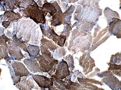 Immunohistochemistry-Paraffin: UBR1 Antibody [NBP3-12361]