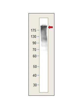 Western Blot: UBR1 Antibody [NBP3-12361]