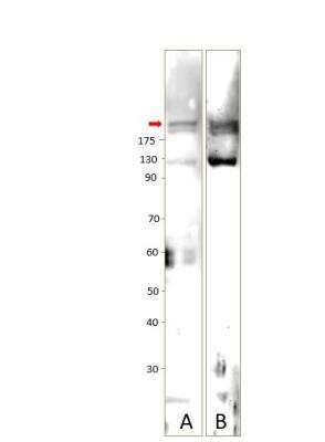 Western Blot: UBR1 Antibody [NBP3-12361]