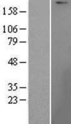 Western Blot: UBR1 Overexpression Lysate [NBP2-05097]