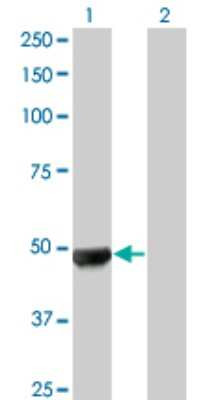 Western Blot: UBR2 Antibody (4G4) [H00023304-M01]