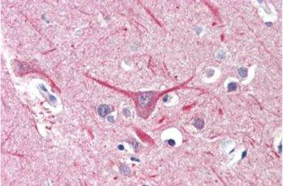 Immunohistochemistry-Paraffin: UBR2 Antibody [NBP1-45243]