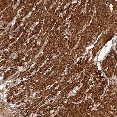 Immunohistochemistry-Paraffin: UBR2 Antibody [NBP1-88759]