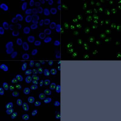 Immunocytochemistry/ Immunofluorescence: UBR2 Antibody (PCRP-UBR2-1D12) - Azide and BSA Free [NBP3-14287]