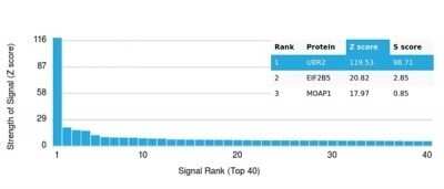 Protein Array: UBR2 Antibody (PCRP-UBR2-1D12) [NBP3-13900]
