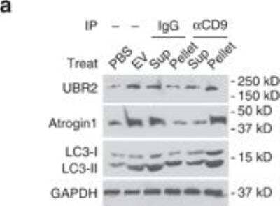 Western Blot: UBR2 Antibody [NBP1-45243]