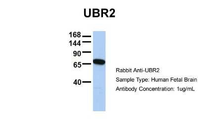 Western Blot: UBR2 Antibody [NBP1-54982]