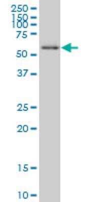 Western Blot: UBR4 Antibody (2D12) [H00023352-M01]