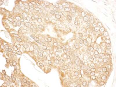 Immunohistochemistry: UBR4 Antibody [NBP1-28724]