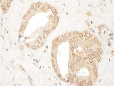 Immunohistochemistry-Paraffin: UBR4 Antibody [NBP1-28730]