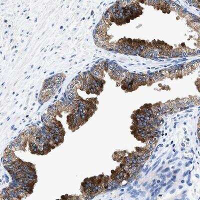 Immunohistochemistry-Paraffin: UBR4 Antibody [NBP1-83003]