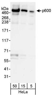 Western Blot: UBR4 Antibody [NBP1-28724]