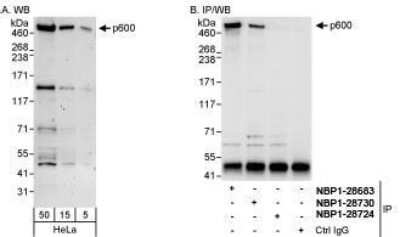 Immunoprecipitation: UBR4 Antibody [NBP1-28730]