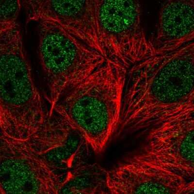 Immunocytochemistry/ Immunofluorescence: UBR5/EDD Antibody [NBP2-58579]