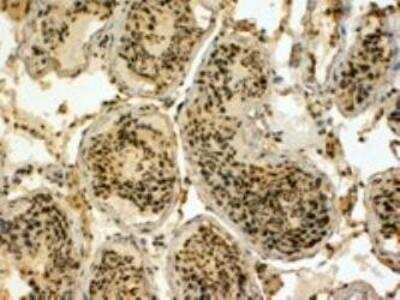 Immunohistochemistry-Paraffin: UBR5/EDD Antibody [NB100-1220]