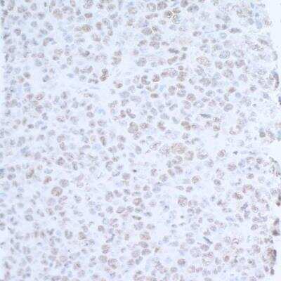 Immunohistochemistry-Paraffin: UBR5/EDD Antibody [NB100-1591]