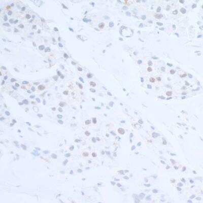 Immunohistochemistry-Paraffin: UBR5/EDD Antibody [NB100-1591]