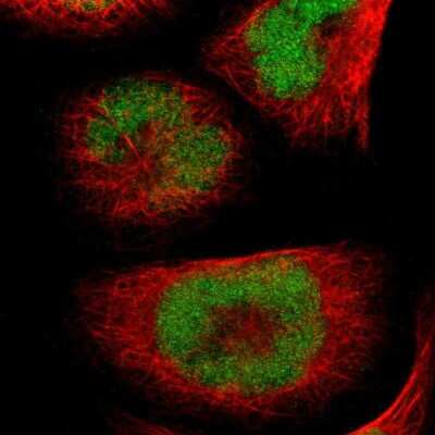 Immunocytochemistry/ Immunofluorescence: UBR7 Antibody [NBP1-88409]