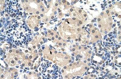 Immunohistochemistry: UBR7 Antibody [NBP2-88539]
