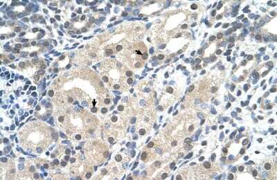 Immunohistochemistry: UBR7 Antibody [NBP2-88540]