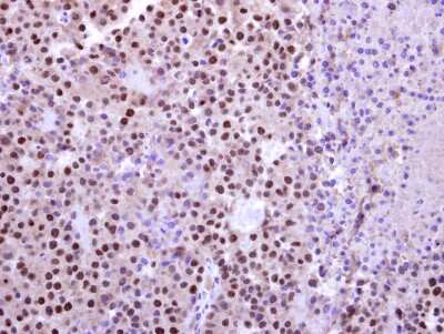 Immunohistochemistry-Paraffin: UBR7 Antibody [NBP2-20794]