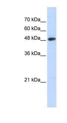 Western Blot: UBR7 Antibody [NBP1-54339]